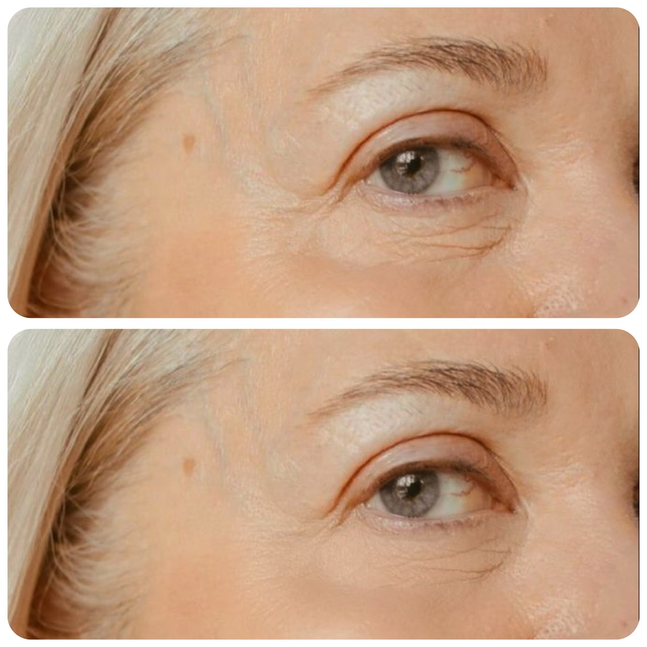 Revitalize Your Skin: Ultimate Anti-Aging Skincare Kit